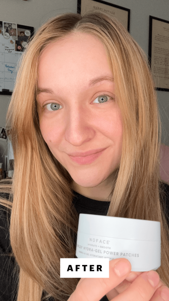 Herrick after applying the NuFace IonPlex HydraGel Power Patches